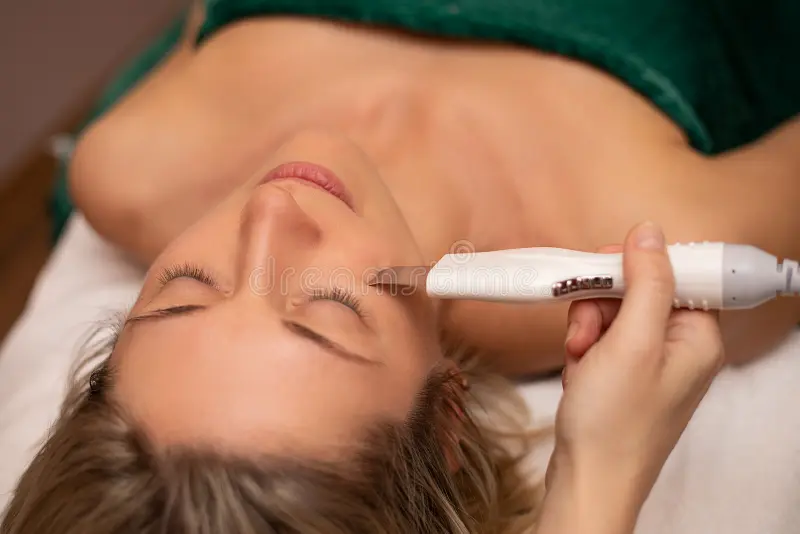 laser hair removal